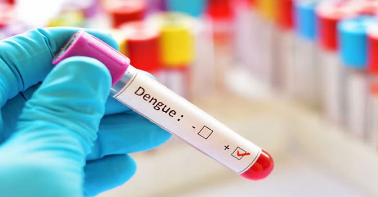 ডেঙ্গু পরীক্ষা নিয়ে ‘প্রতারণা