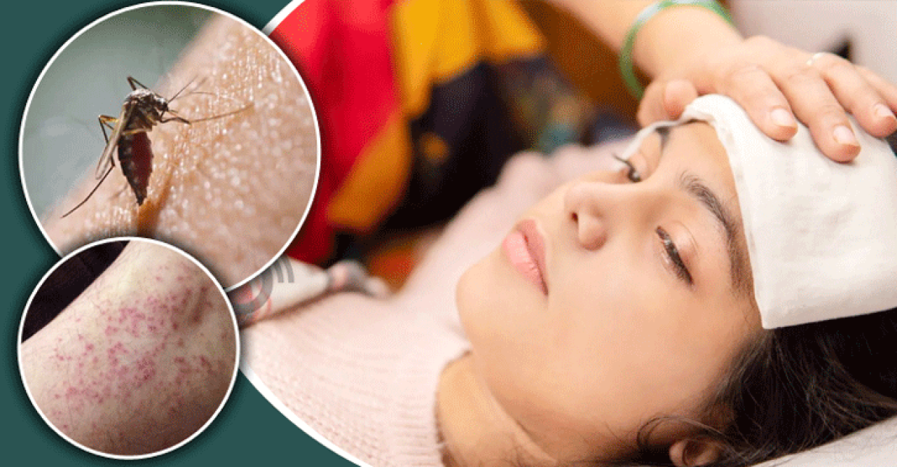 এক দিনে ডেঙ্গুতে রেকর্ড মৃত্যু