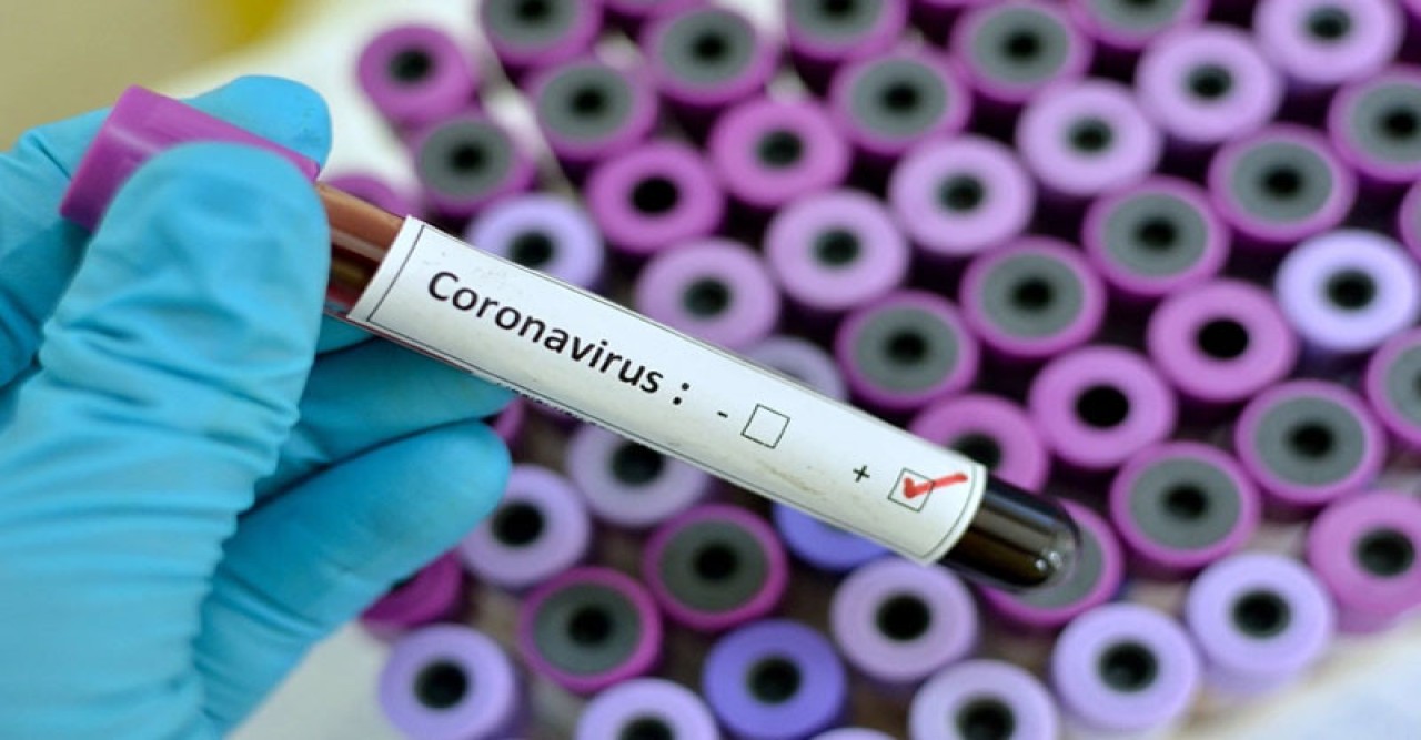 করোনায় ২৪ ঘণ্টায় ২ জনের মৃত্যু, শনাক্ত ১৫